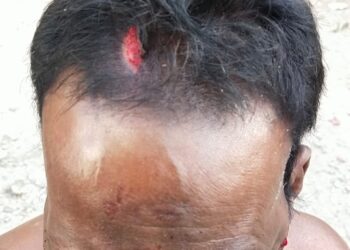 திருப்பூர் மக்களை அச்சத்தில் ஆழ்த்தும் சிறுத்தையை வனத்துறை திணறல்