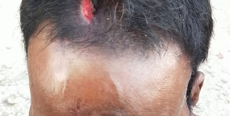 திருப்பூர் மக்களை அச்சத்தில் ஆழ்த்தும் சிறுத்தையை வனத்துறை திணறல்